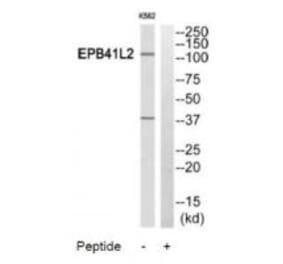 Western blot - PPP2R5A Antibody from Signalway Antibody (35029) - Antibodies.com