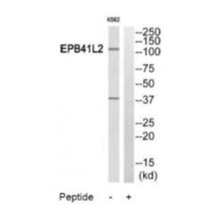 Western blot - PPP2R5A Antibody from Signalway Antibody (35029) - Antibodies.com