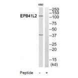 Western blot - PPP2R5A Antibody from Signalway Antibody (35029) - Antibodies.com