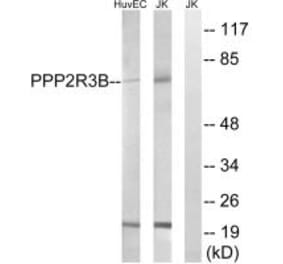 Western blot - PPP2R5D Antibody from Signalway Antibody (35030) - Antibodies.com