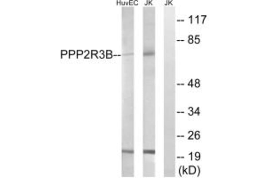 Western blot - PPP2R5D Antibody from Signalway Antibody (35030) - Antibodies.com