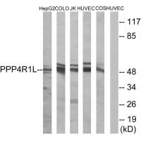 Western blot analysis of extracts from HepG2 cells, COLO cells, Jurkat cells, HUVEC cells and COS cells, using PPP4R1L antibody #35034.