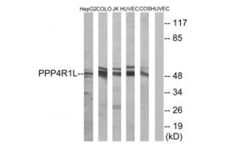 Western blot - PPP4R1L Antibody from Signalway Antibody (35034) - Antibodies.com