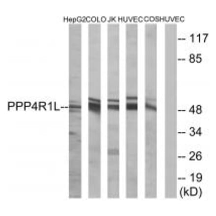 Western blot - PPP4R1L Antibody from Signalway Antibody (35034) - Antibodies.com