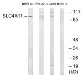 Western blot - SLC4A11 Antibody from Signalway Antibody (35052) - Antibodies.com