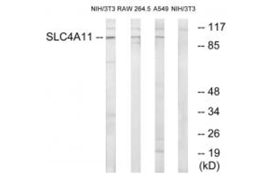 Western blot - SLC4A11 Antibody from Signalway Antibody (35052) - Antibodies.com