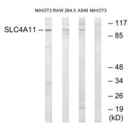 Western blot - SLC4A11 Antibody from Signalway Antibody (35052) - Antibodies.com