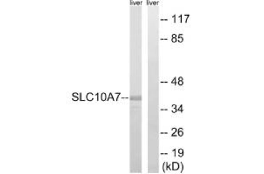 Western blot - SLC10A7 Antibody from Signalway Antibody (35058) - Antibodies.com