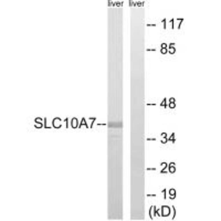 Western blot - SLC10A7 Antibody from Signalway Antibody (35058) - Antibodies.com