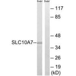 Western blot - SLC10A7 Antibody from Signalway Antibody (35058) - Antibodies.com