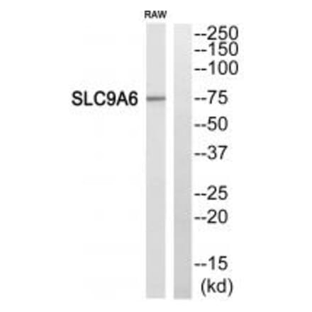 Western blot - SLC9A6 Antibody from Signalway Antibody (35059) - Antibodies.com