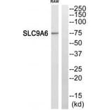 Western blot - SLC9A6 Antibody from Signalway Antibody (35059) - Antibodies.com