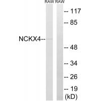 Western blot analysis of extracts from RAW264.7 cells, using SLC24A4 antibody #35062.