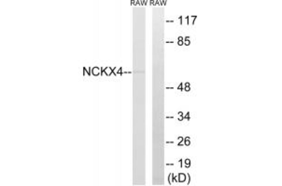 Western blot - SLC24A4 Antibody from Signalway Antibody (35062) - Antibodies.com