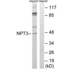 Western blot - SLC17A2 Antibody from Signalway Antibody (35065) - Antibodies.com