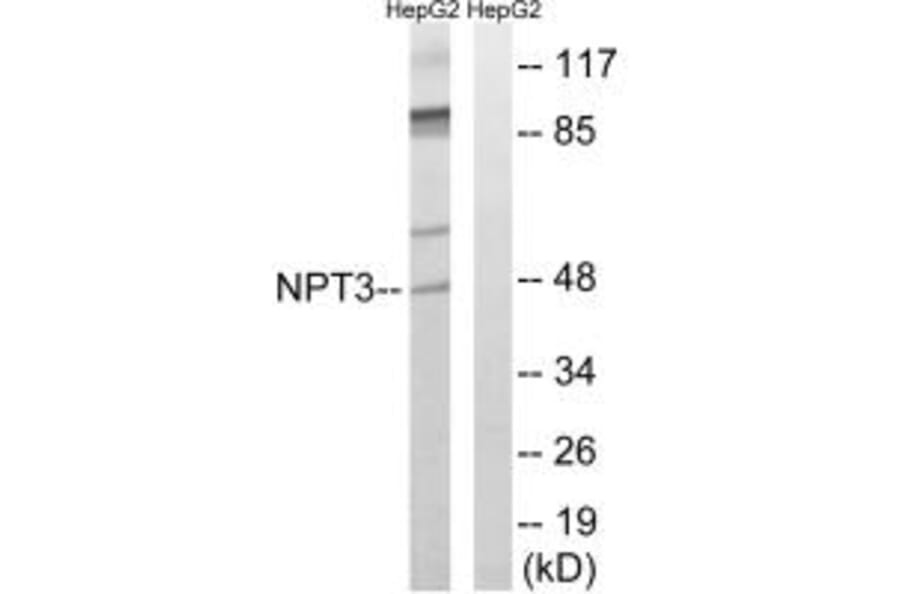 Western blot - SLC17A2 Antibody from Signalway Antibody (35065) - Antibodies.com