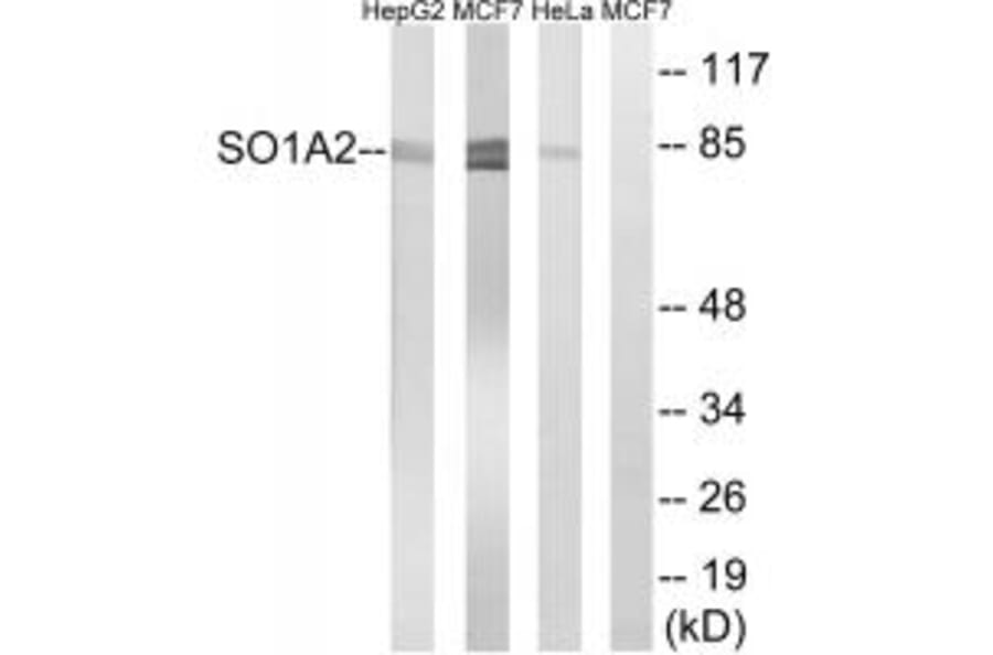 Western blot - SLCO1A2 Antibody from Signalway Antibody (35067) - Antibodies.com