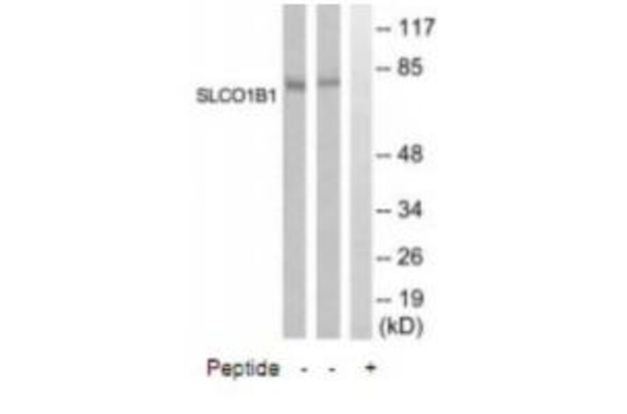 Western blot - SLCO1B1 Antibody from Signalway Antibody (35068) - Antibodies.com