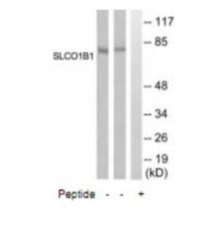 Western blot - SLCO1B1 Antibody from Signalway Antibody (35068) - Antibodies.com
