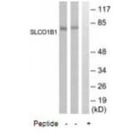 Western blot - SLCO1B1 Antibody from Signalway Antibody (35068) - Antibodies.com