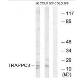 Western blot - TRAPPC3 Antibody from Signalway Antibody (35098) - Antibodies.com