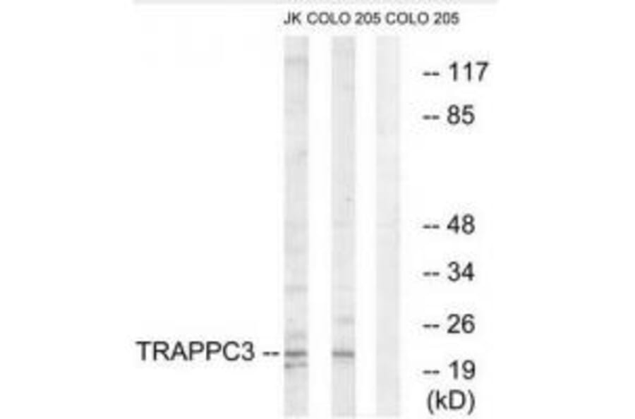 Western blot - TRAPPC3 Antibody from Signalway Antibody (35098) - Antibodies.com
