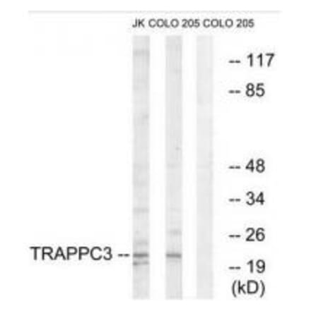 Western blot - TRAPPC3 Antibody from Signalway Antibody (35098) - Antibodies.com