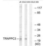 Western blot - TRAPPC3 Antibody from Signalway Antibody (35098) - Antibodies.com