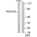 Western blot - TCF4/12 Antibody from Signalway Antibody (35102) - Antibodies.com