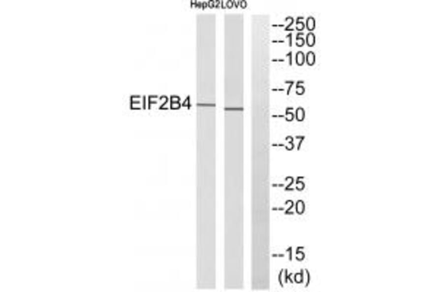 Western blot - EIF2B4 Antibody from Signalway Antibody (35107) - Antibodies.com