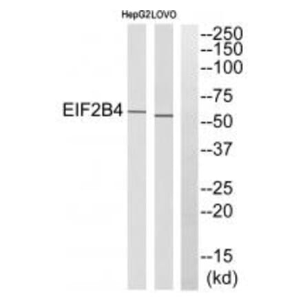 Western blot - EIF2B4 Antibody from Signalway Antibody (35107) - Antibodies.com