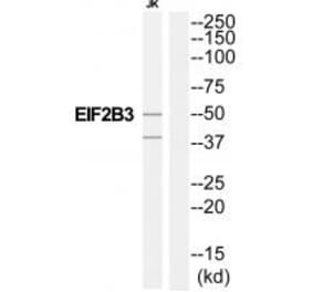 Western blot - EIF2B3 Antibody from Signalway Antibody (35108) - Antibodies.com