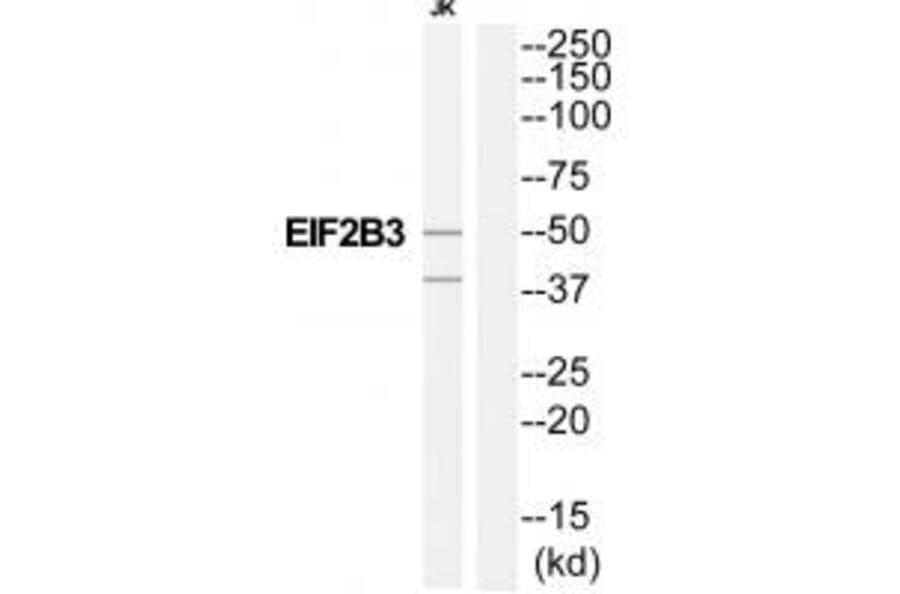 Western blot - EIF2B3 Antibody from Signalway Antibody (35108) - Antibodies.com