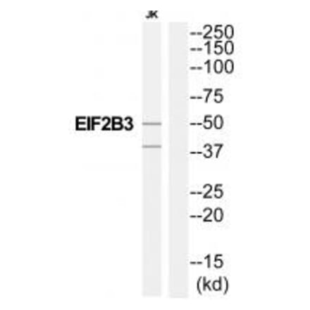 Western blot - EIF2B3 Antibody from Signalway Antibody (35108) - Antibodies.com