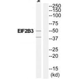 Western blot - EIF2B3 Antibody from Signalway Antibody (35108) - Antibodies.com