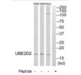 Western blot - UBE2D2 Antibody from Signalway Antibody (35132) - Antibodies.com
