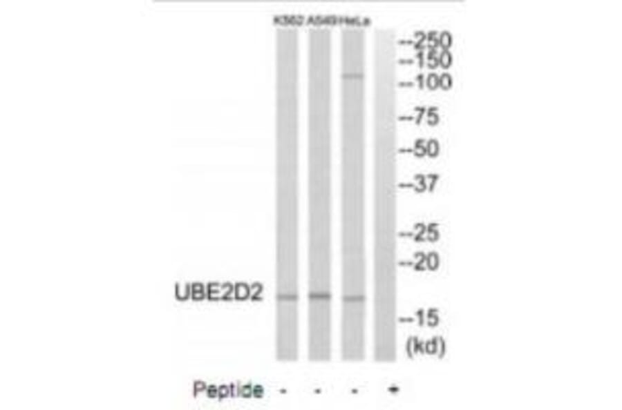 Western blot - UBE2D2 Antibody from Signalway Antibody (35132) - Antibodies.com