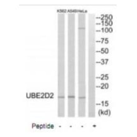 Western blot - UBE2D2 Antibody from Signalway Antibody (35132) - Antibodies.com