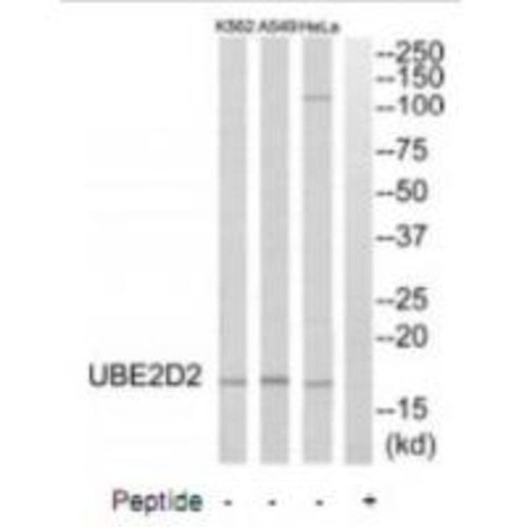 Western blot - UBE2D2 Antibody from Signalway Antibody (35132) - Antibodies.com