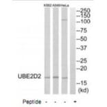 Western blot - UBE2D2 Antibody from Signalway Antibody (35132) - Antibodies.com