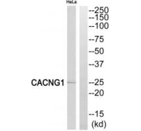 Western blot - CACNG1 Antibody from Signalway Antibody (35143) - Antibodies.com