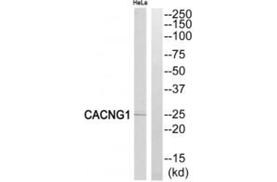 Western blot - CACNG1 Antibody from Signalway Antibody (35143) - Antibodies.com