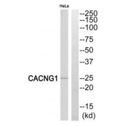 Western blot - CACNG1 Antibody from Signalway Antibody (35143) - Antibodies.com