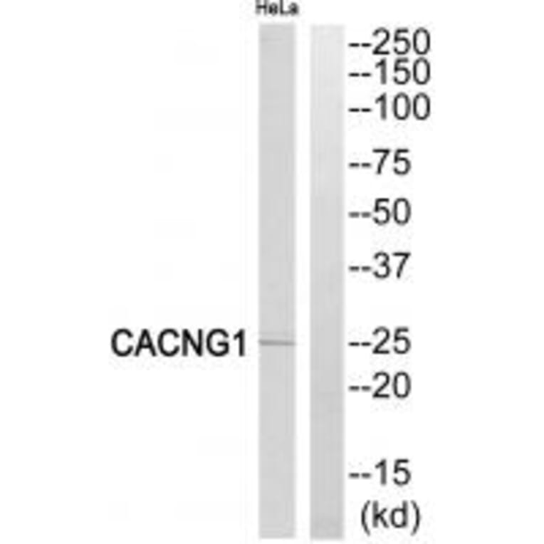 Western blot - CACNG1 Antibody from Signalway Antibody (35143) - Antibodies.com