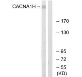 Western blot - CACNA1H Antibody from Signalway Antibody (35145) - Antibodies.com