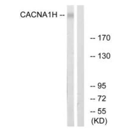 Western blot - CACNA1H Antibody from Signalway Antibody (35145) - Antibodies.com
