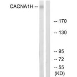 Western blot - CACNA1H Antibody from Signalway Antibody (35145) - Antibodies.com