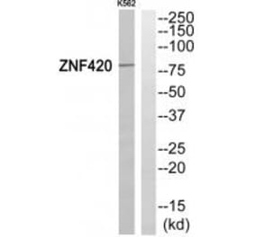 Western blot - ZNF420 Antibody from Signalway Antibody (35157) - Antibodies.com