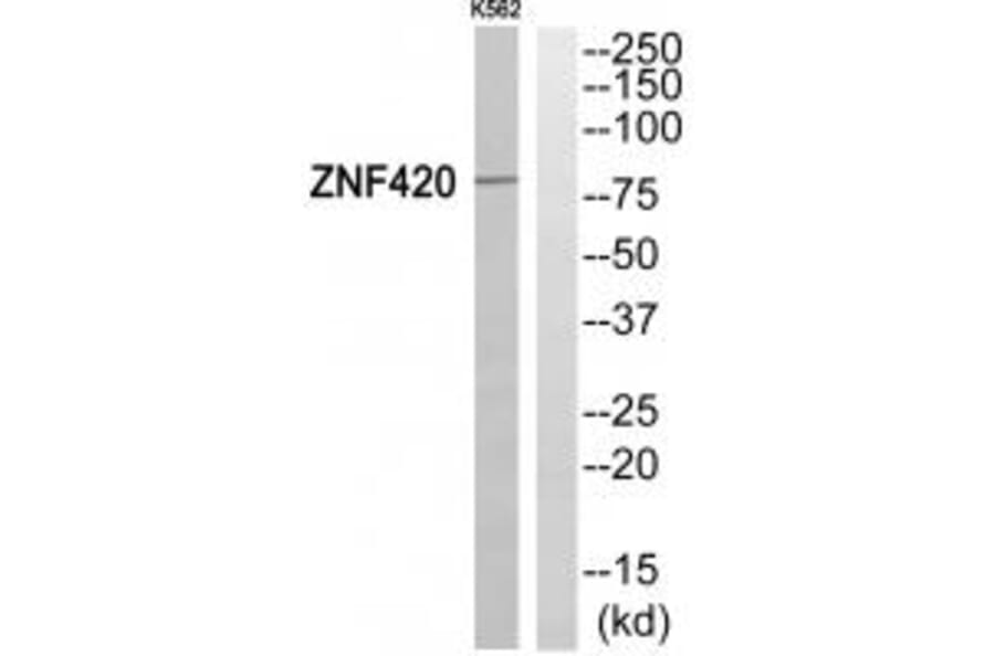 Western blot - ZNF420 Antibody from Signalway Antibody (35157) - Antibodies.com