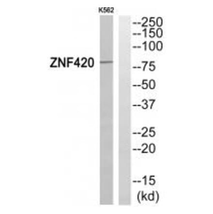 Western blot - ZNF420 Antibody from Signalway Antibody (35157) - Antibodies.com